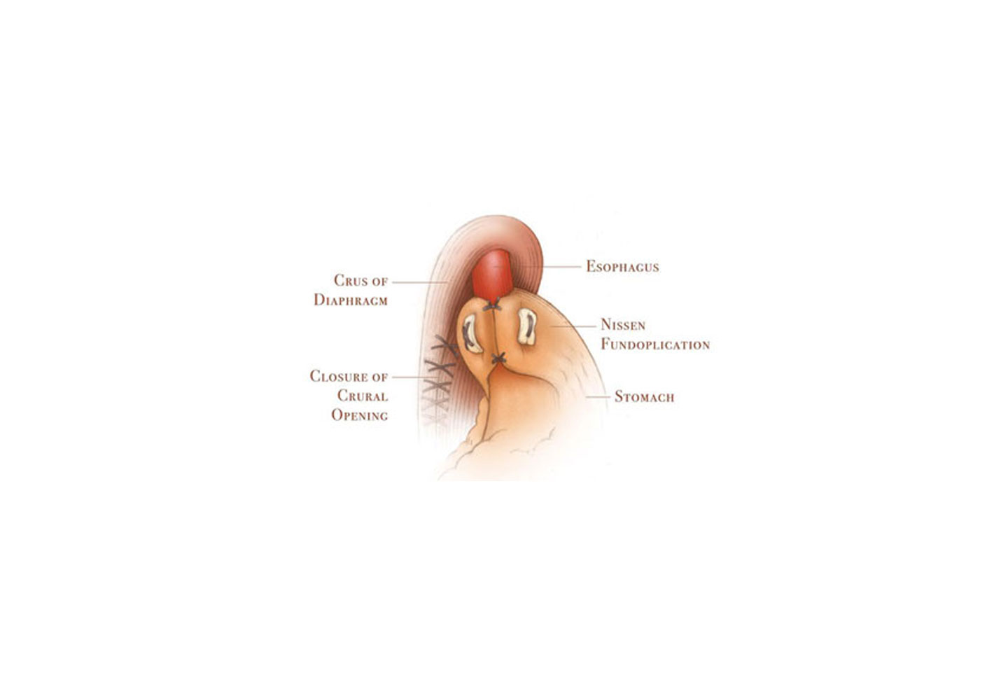 Blog Article Figure